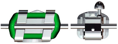 Vergleich herkoemmliches Bracket und SPEED Mini Bracket